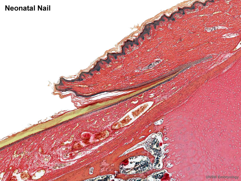 File:Neonatal nail.jpg