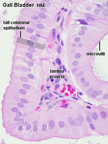 File:Gall bladder histology 002.jpg