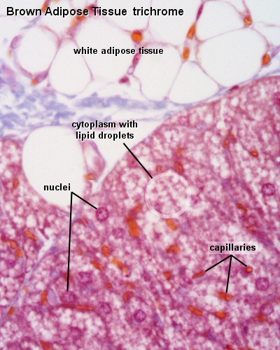 File:Brown adipose histology.jpg