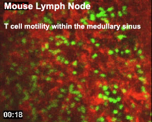 File:Mouse adult lymph node 03.jpg