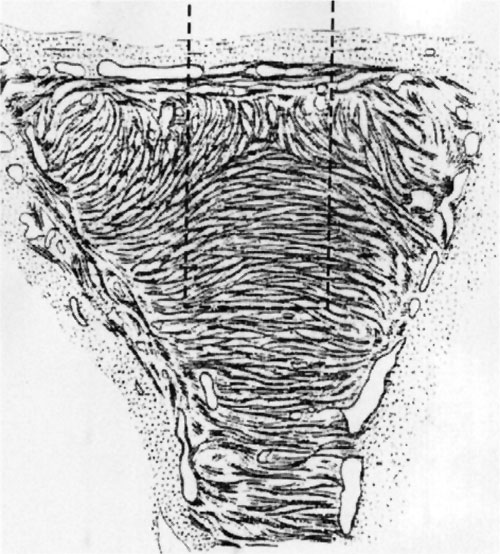 File:Human fetal uterus myometrium.jpg