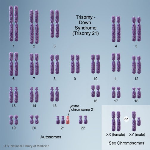 File:Chromosome- trisomy.jpg