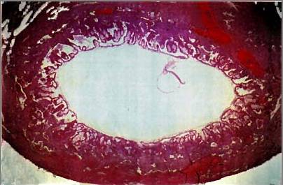 Human embryo 16-18 days 01.jpg