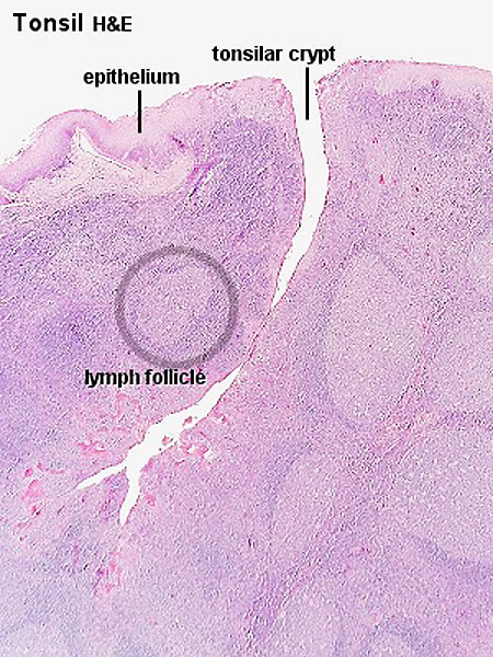File:Tonsil histology 01.jpg
