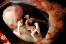 Fetus week 9-10-icon.jpg