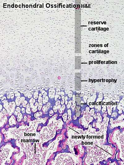 File:Endochondral ossification.jpg