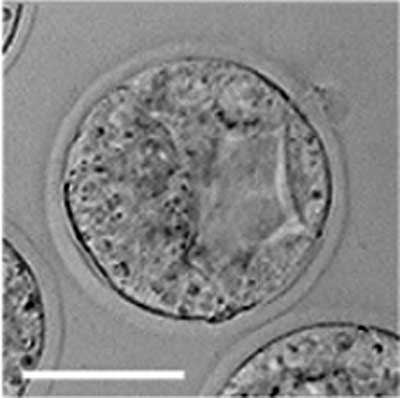 File:Mouse-early blastocyst 01.jpg