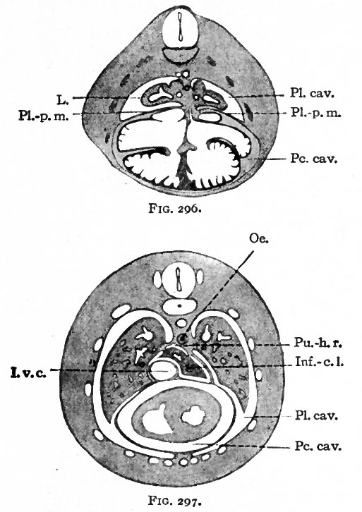 Pericardial Cavity