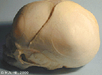 Skull lateral view.gif