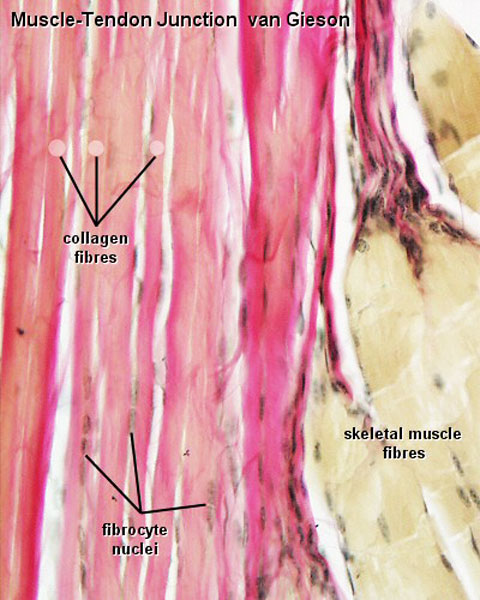 File:Skeletal muscle histology 044.jpg