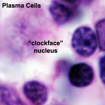 File:Plasma cell clockface nucleus 01.jpg