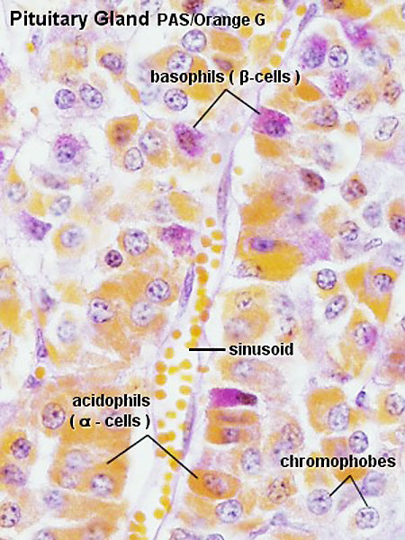 File:Pituitary histology 002.jpg
