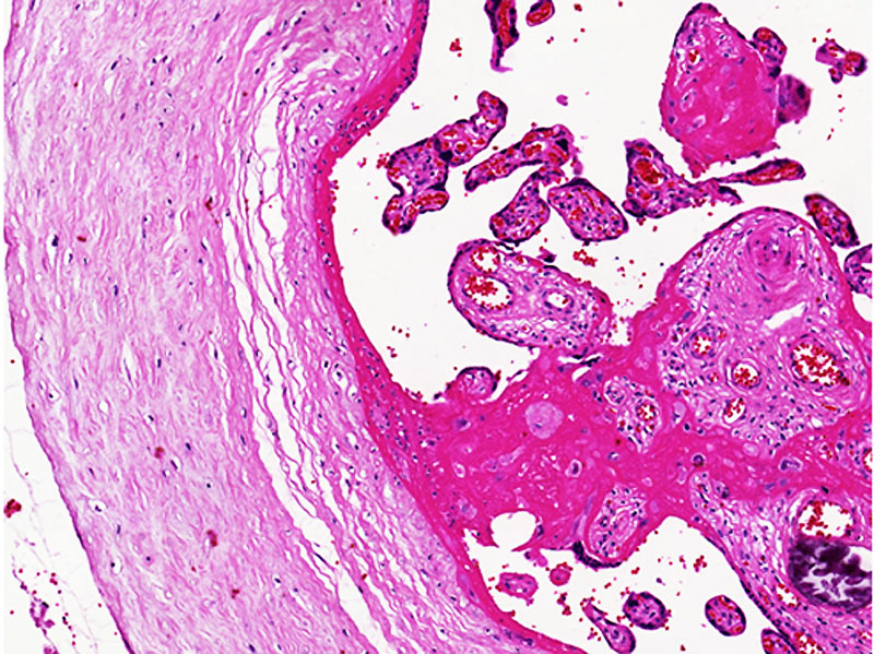 File:Placenta histology 008.jpg