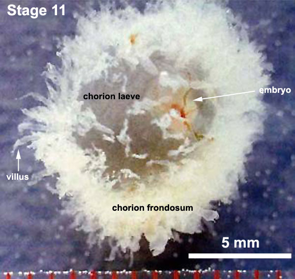 File:Embryo-membranes stage 11.jpg
