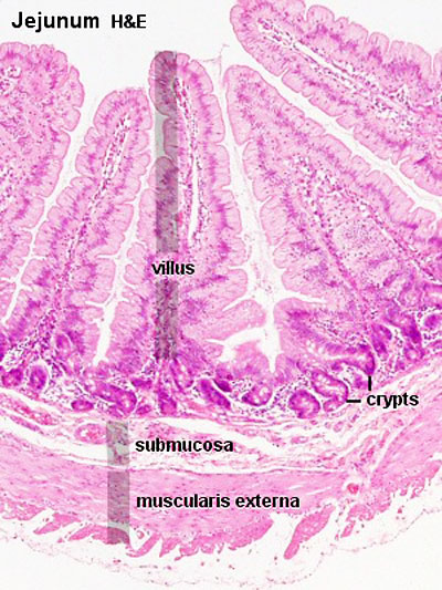 File:Intestine histology 004.jpg