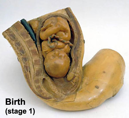 File:Galletti1770 birth wax model.jpg