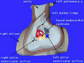 File:Heart-ventricular-septum-02.jpg