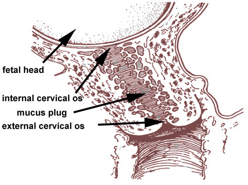 File:Cervical mucus plug.jpg