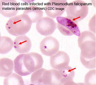 File:Malaria plasmodium falciparum.jpg