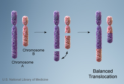 File:Chromosome- balanced translocation.jpg