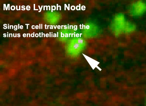 File:Mouse adult lymph node 04.jpg