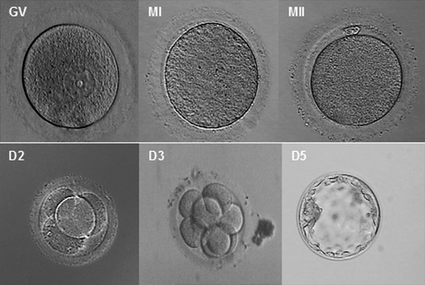 File:Human-oocyte to blastocyst.jpg