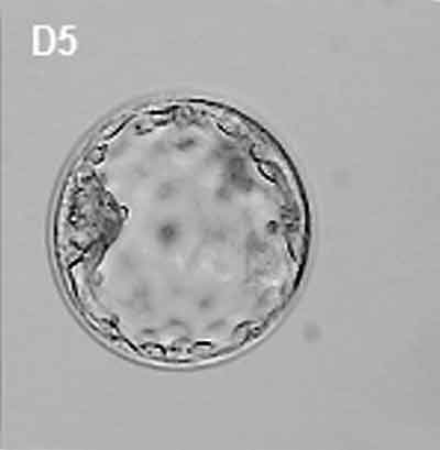 File:Human embryo day 5.jpg