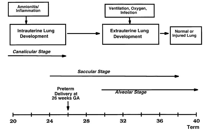 File:Preterm delivery and lung development.jpg