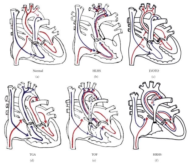 Fetal heart diagram blood flow