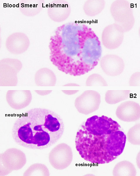 File:Neutrophil and eosinophil 01.jpg