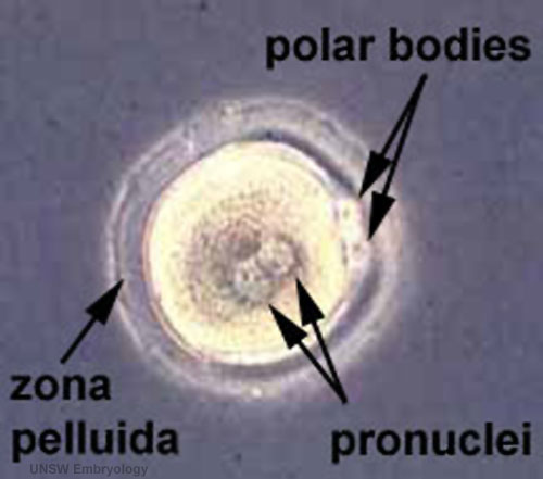 File:Early zygote labelled.jpg