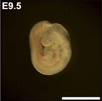 File:Mouse- embryo E9.5.jpg