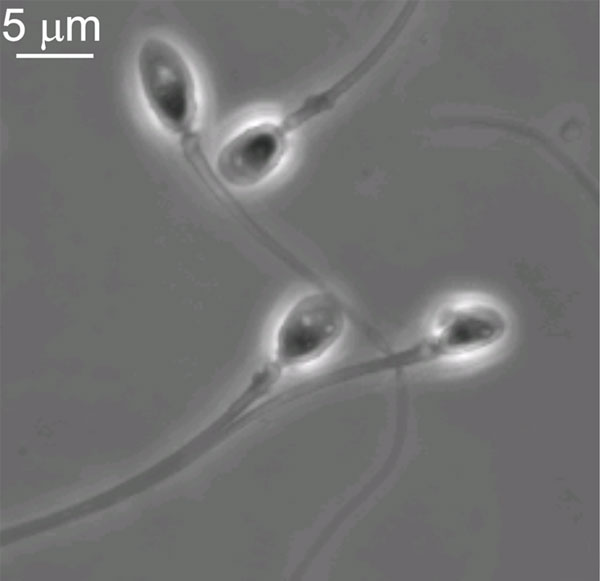 File:Human-spermatozoa.jpg
