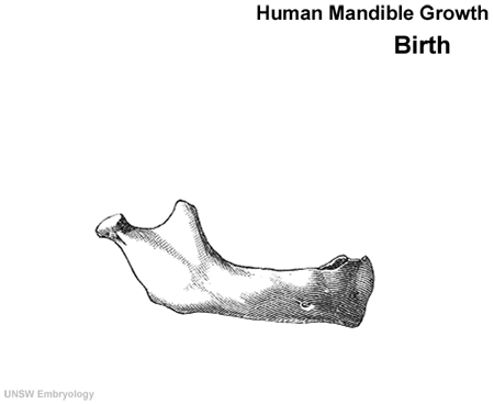 File:Postnatal human mandible growth 1.gif