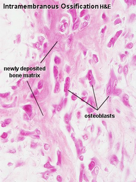 File:Intramembranous ossification centre.jpg