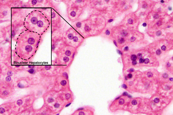 File:Liver histology 004.jpg