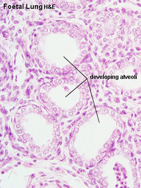 File:Fetal lung histology.jpg