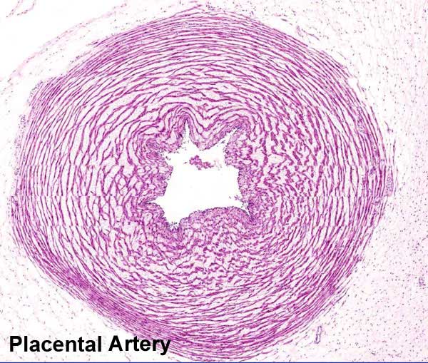 File:Placental artery.jpg