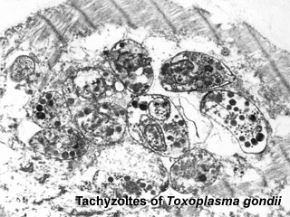 Toxoplasma tachyzoites
