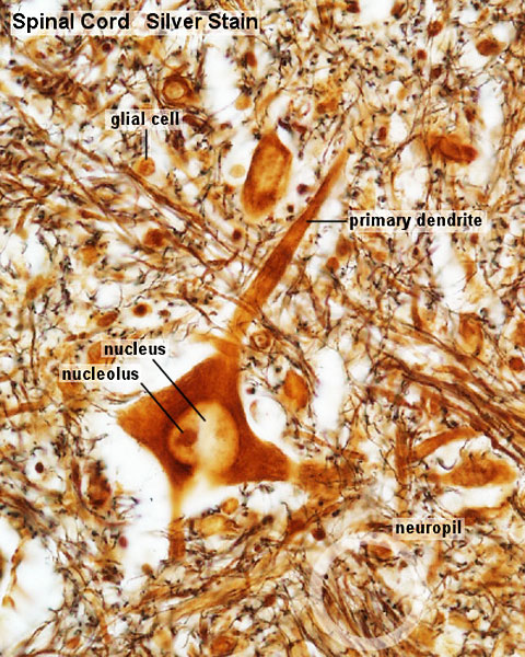 File:Spinal cord histology 12.jpg