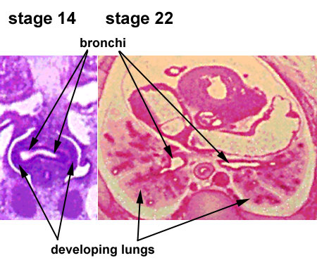 Stage14-22 lungs.jpg