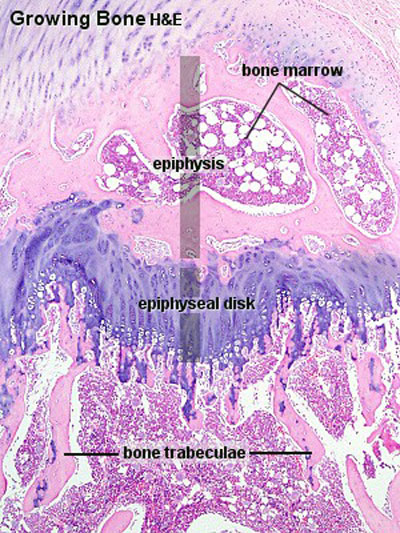 File:Endochondral ossification 2.jpg