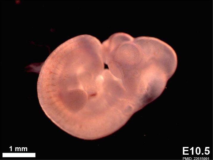 Mouse embryo E10.5.jpg
