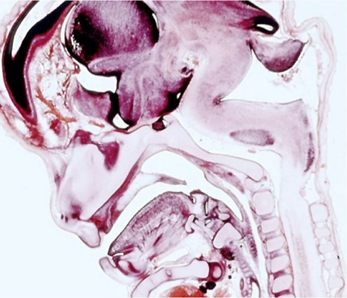 File:Fetal week 9 head lateral 01.jpg
