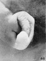 Fig. 46. Embryo No. 1845, 87 mm.