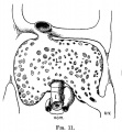 Fig 11 human embryo 4 mm