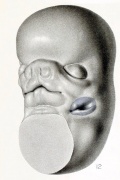 Embryo 18mm