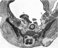 Fig. 7. Transverse section of a 42 mm embryo H 42