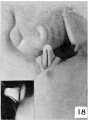 Fig. 18. Carnegie Embryo No.1022d