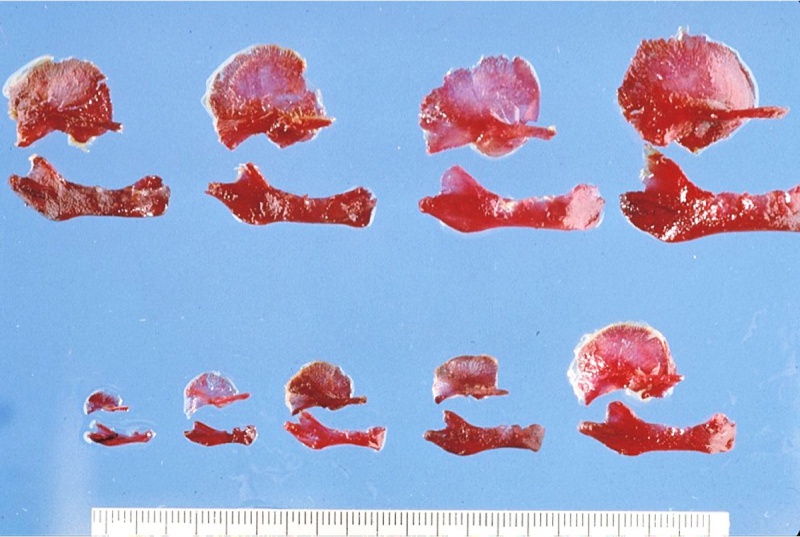 File:Human fetal temporal bone and mandible 01.jpg